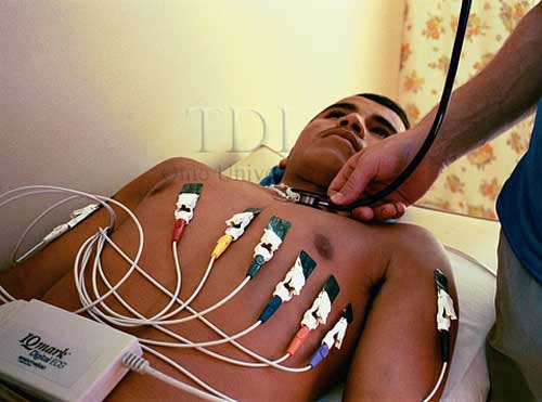 ekg